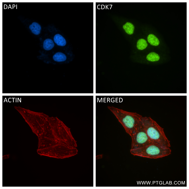 IF Staining of HepG2 using 83976-3-RR (same clone as 83976-3-PBS)