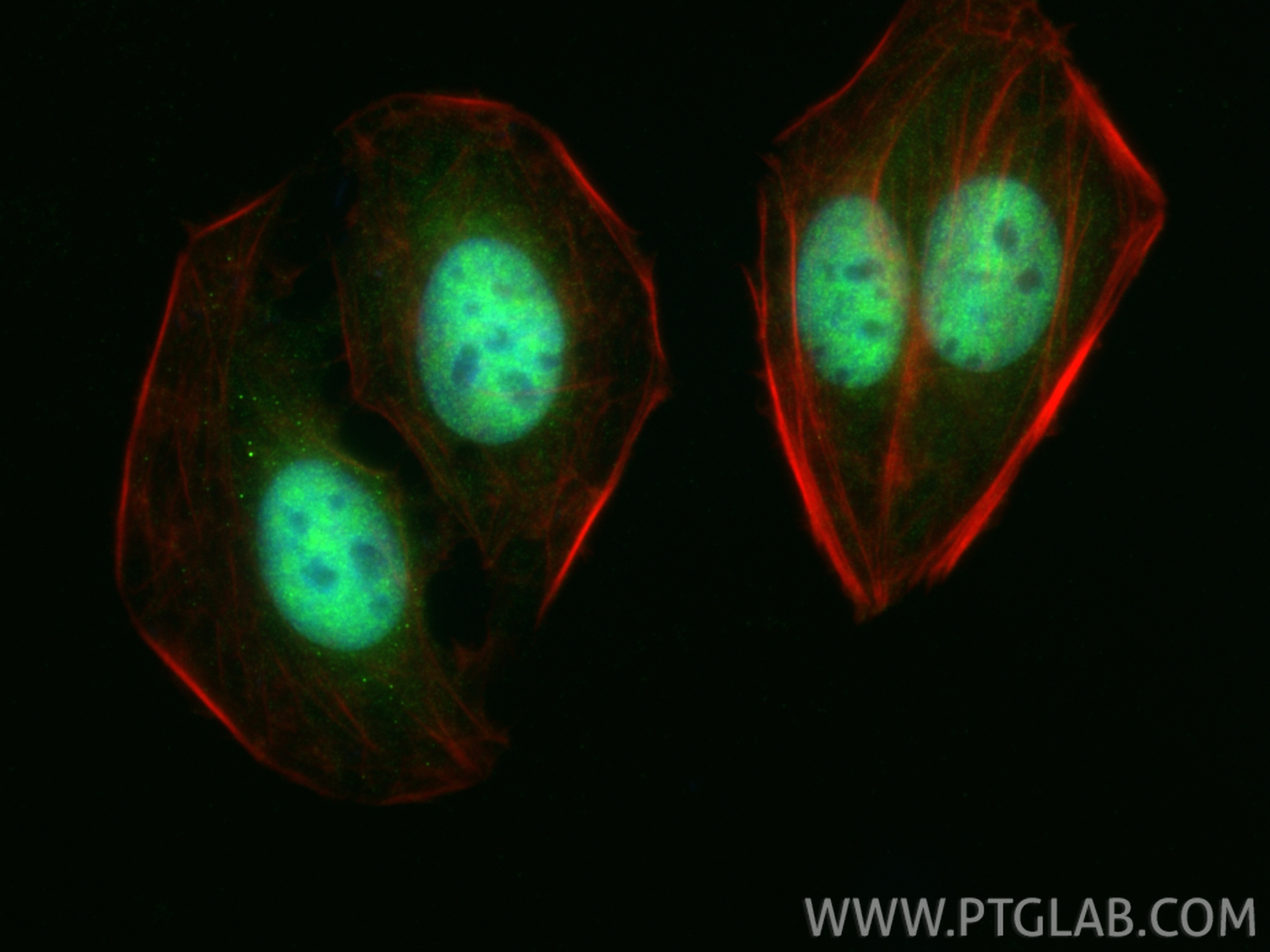 IF Staining of U2OS using 11705-1-AP