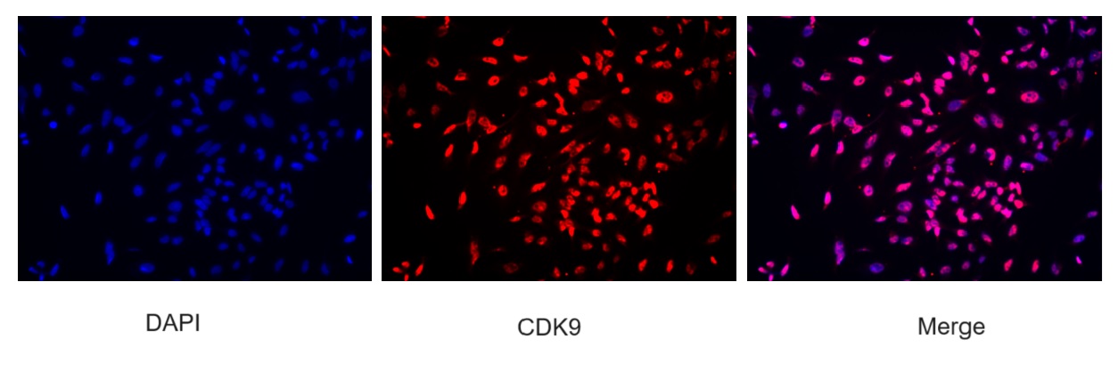IF Staining of HeLa using 67256-1-Ig (same clone as 67256-1-PBS)
