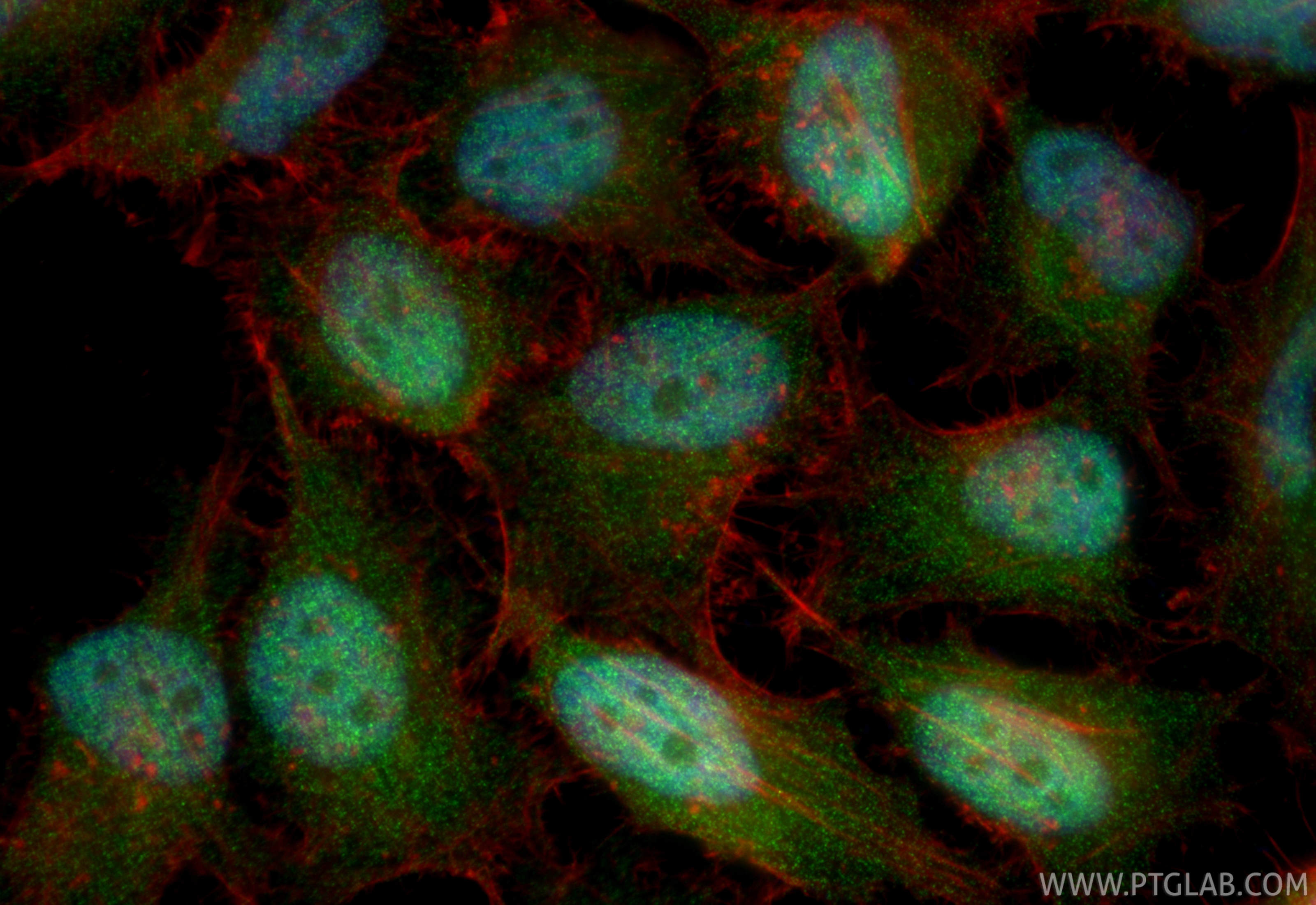 IF Staining of HeLa using RMX00056