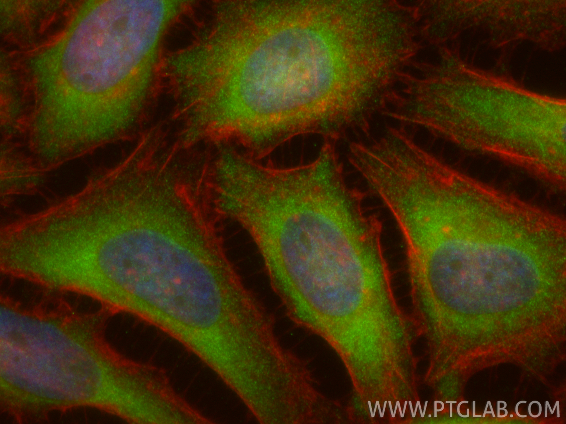 IF Staining of HeLa using 22988-1-AP IF Staining of HeLa using 22988-1-AP