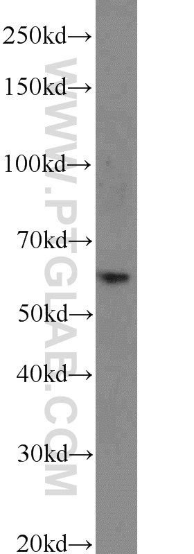 WB analysis of mouse lung using 22988-1-AP