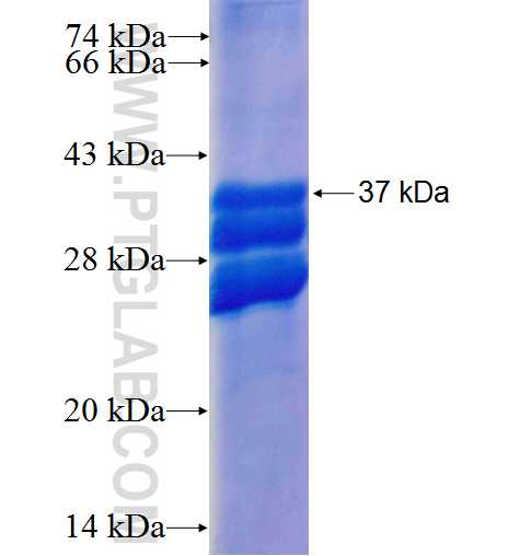 CDKL1 fusion protein Ag22541 SDS-PAGE