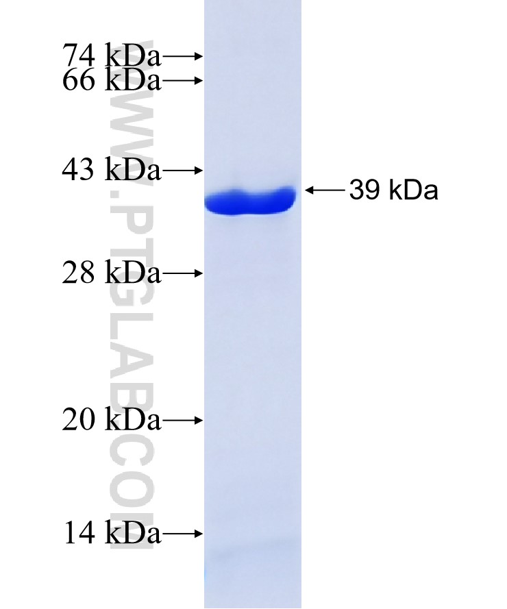CDKL5 fusion protein Ag29091 SDS-PAGE CDKL5 fusion protein Ag29091 SDS-PAGE