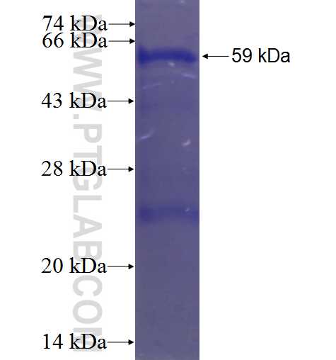 CDKL5 fusion protein Ag3531 SDS-PAGE