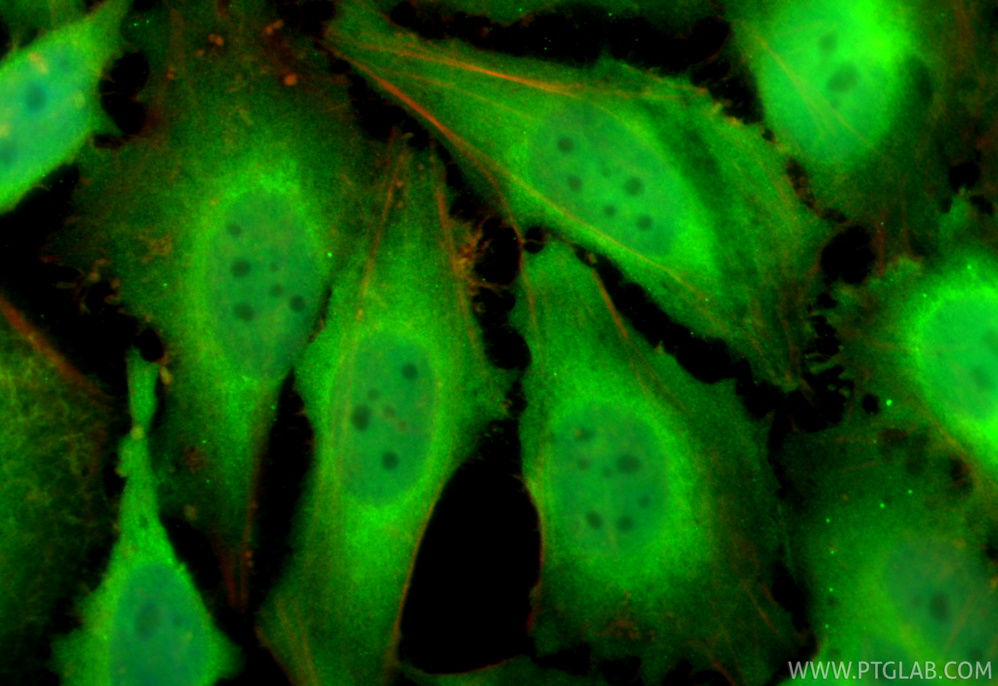 IF Staining of HeLa using RMX00038 IF Staining of HeLa using RMX00038