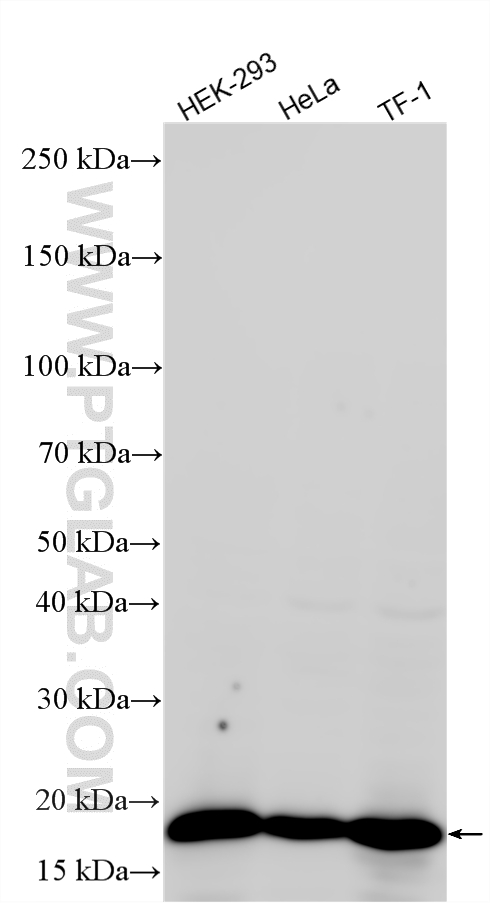 WB analysis using RMX00038 WB analysis using RMX00038