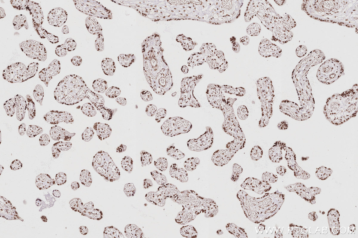 IHC staining of human placenta using 16615-1-AP IHC staining of human placenta using 16615-1-AP