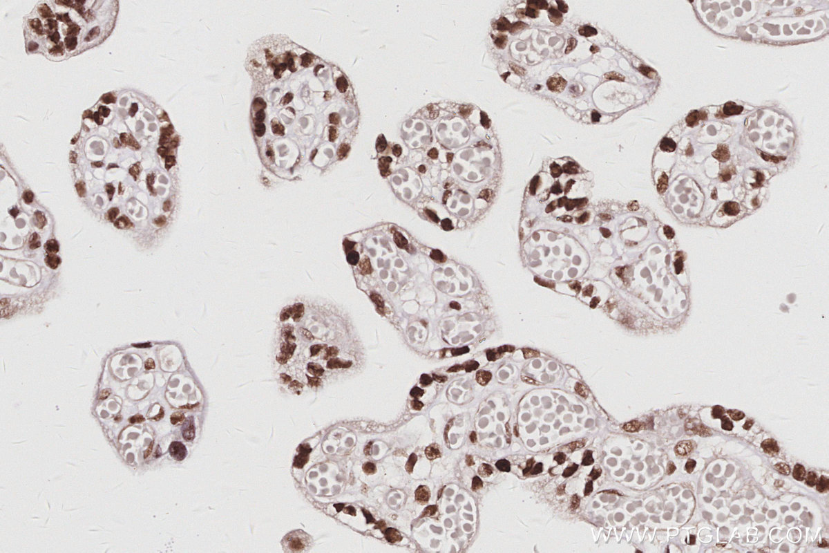 IHC staining of human placenta using 16615-1-AP IHC staining of human placenta using 16615-1-AP