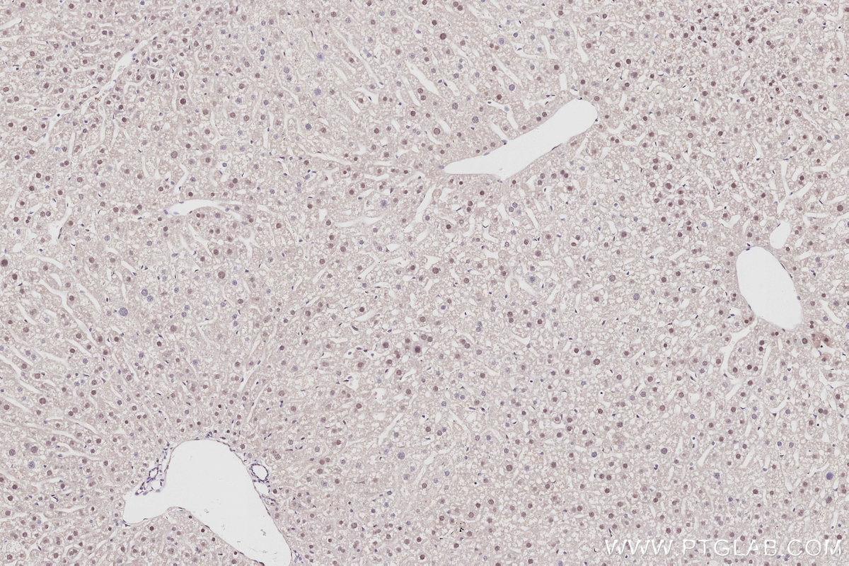 IHC staining of mouse liver using 16615-1-AP IHC staining of mouse liver using 16615-1-AP
