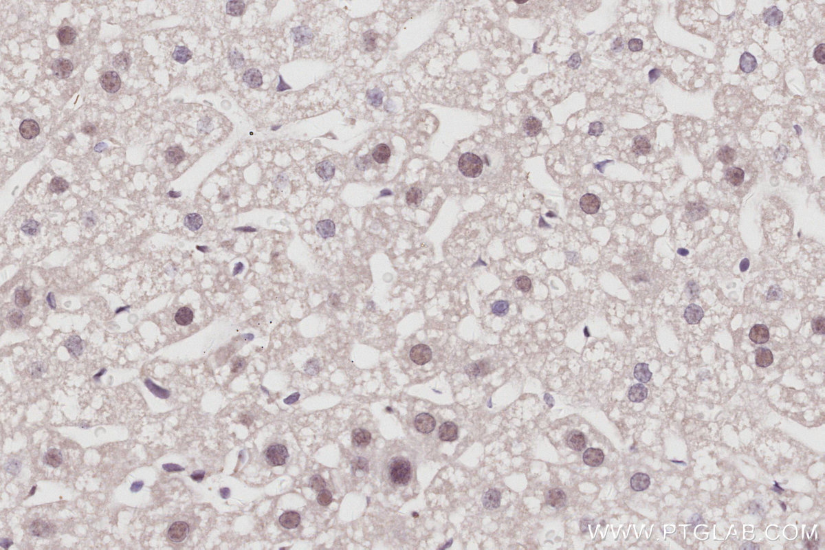 IHC staining of mouse liver using 16615-1-AP IHC staining of mouse liver using 16615-1-AP