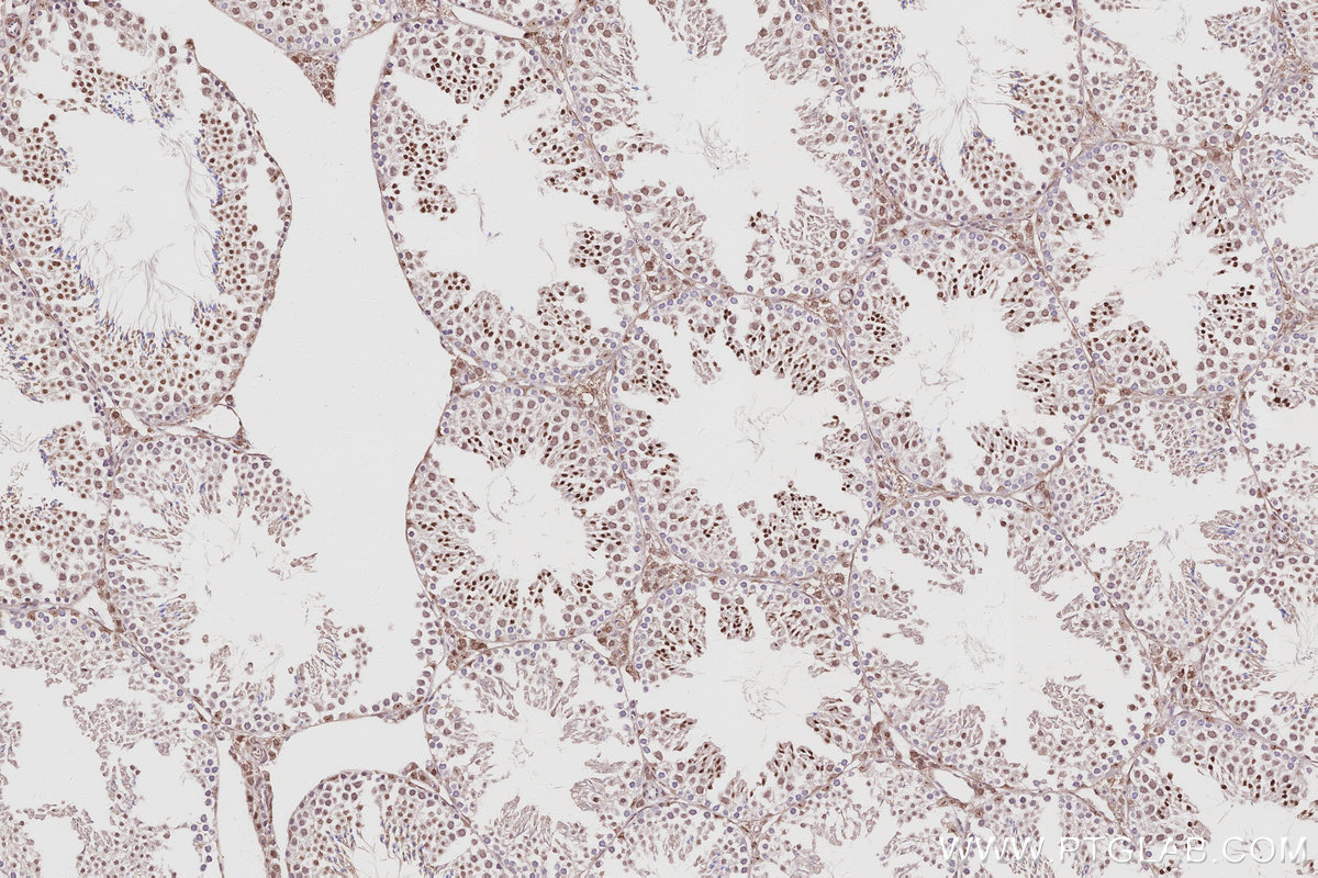 IHC staining of mouse testis using 16615-1-AP IHC staining of mouse testis using 16615-1-AP