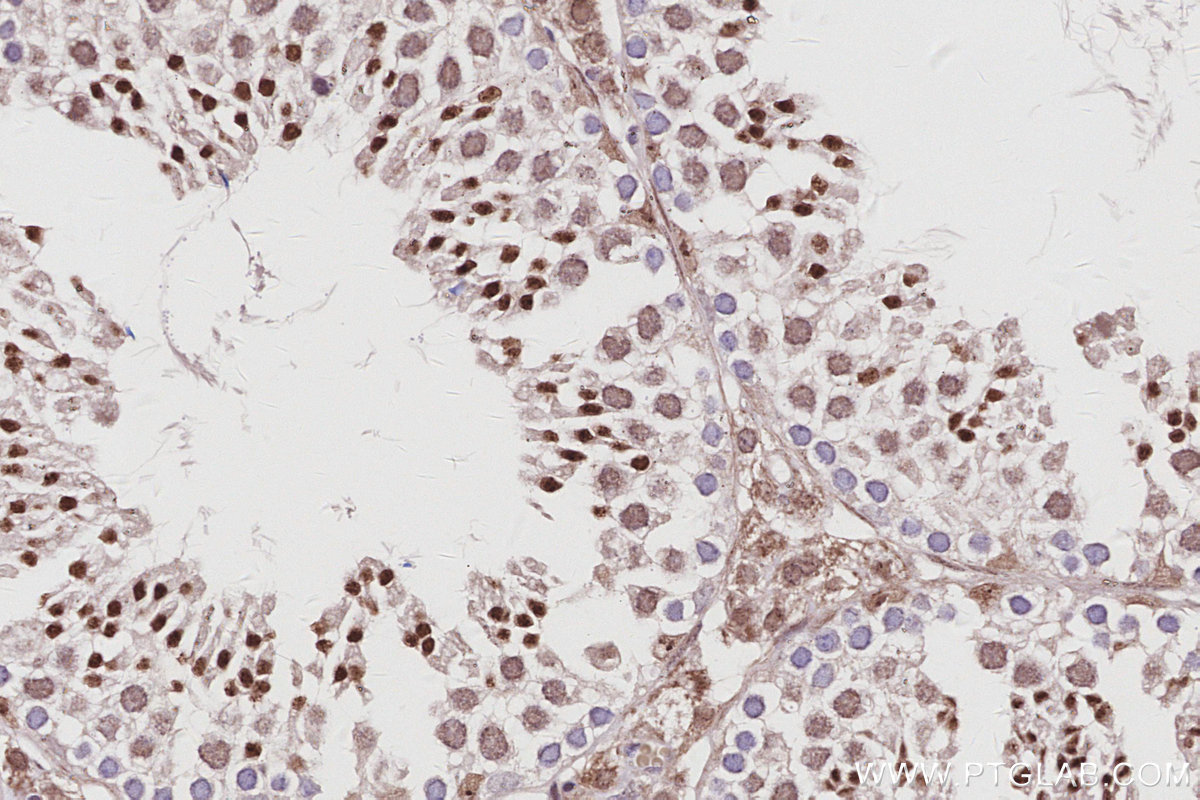IHC staining of mouse testis using 16615-1-AP IHC staining of mouse testis using 16615-1-AP