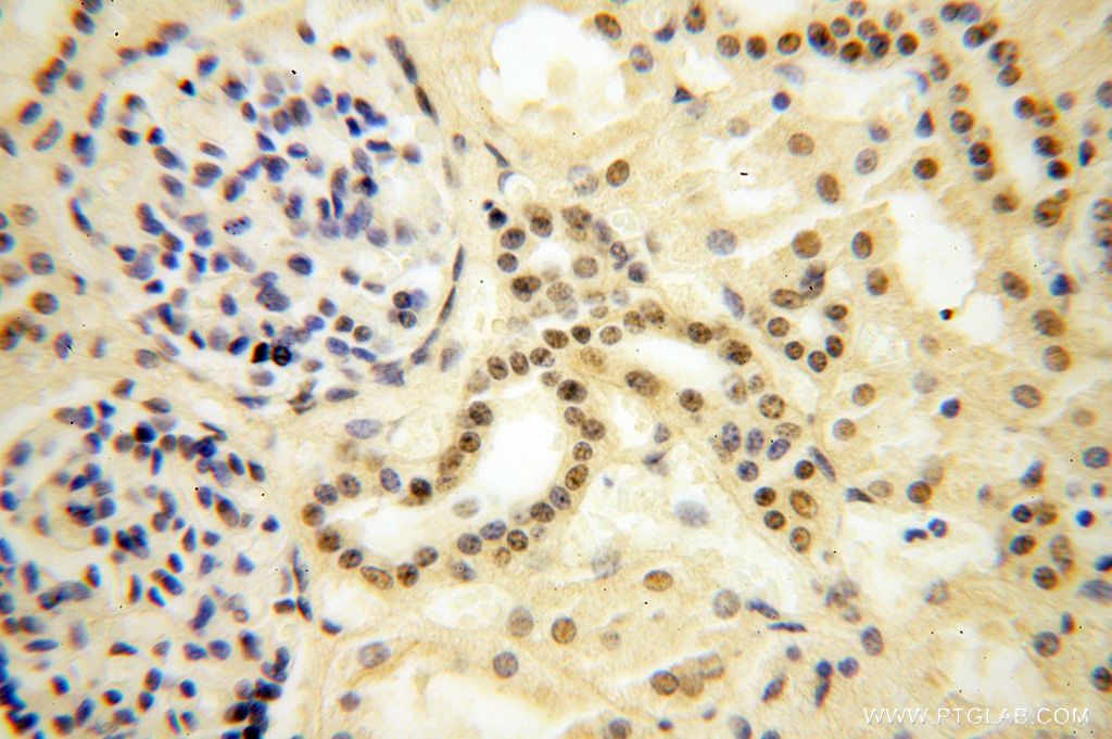 IHC staining of human kidney using 16615-1-AP