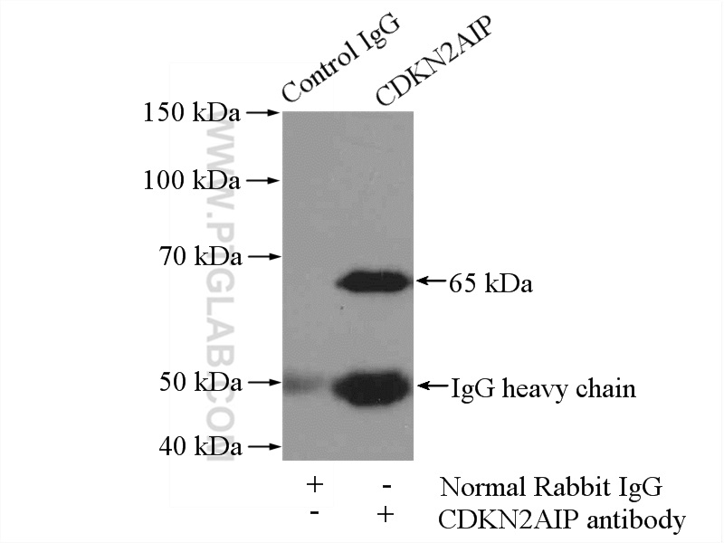 IP experiment of HeLa using 16615-1-AP