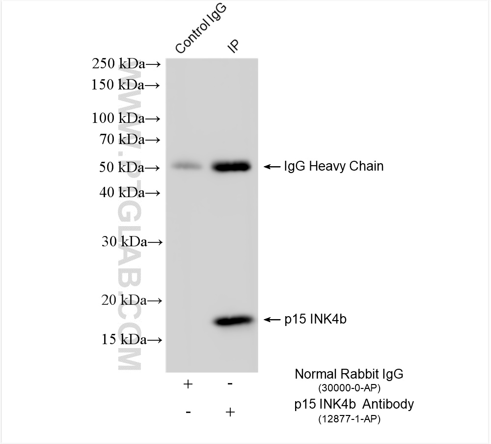 IP experiment of HeLa using 12877-1-AP