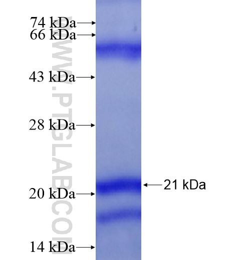CDKN2B fusion protein Ag16059 SDS-PAGE CDKN2B fusion protein Ag16059 SDS-PAGE