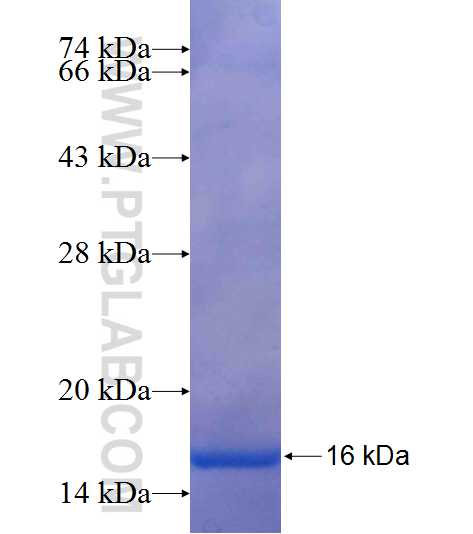 CDKN2C fusion protein Ag25413 SDS-PAGE