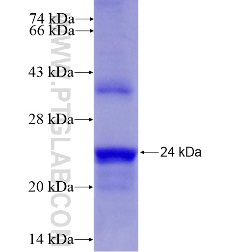 CDKN2C fusion protein Ag15409 SDS-PAGE