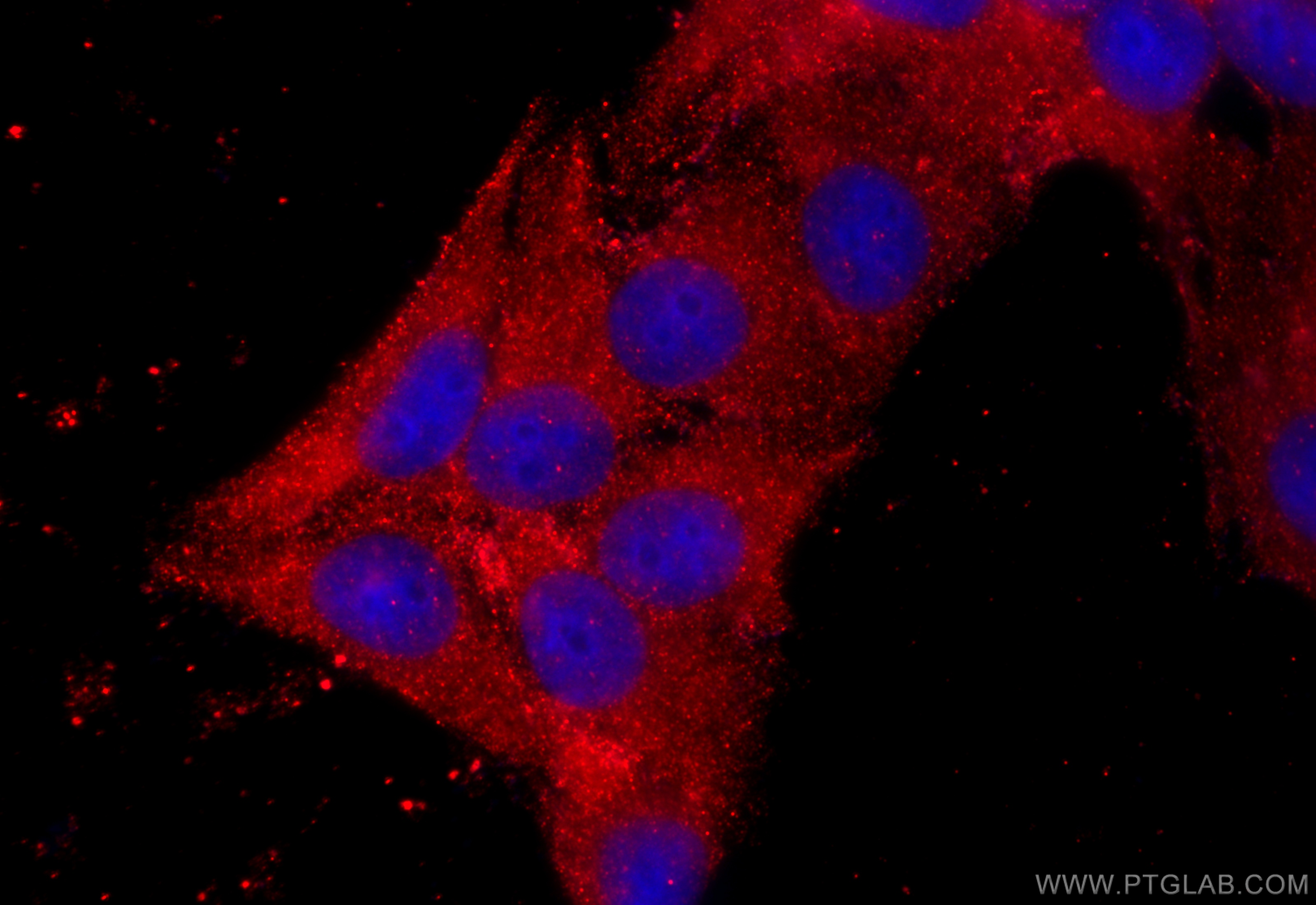 IF Staining of HepG2 using 12589-1-AP