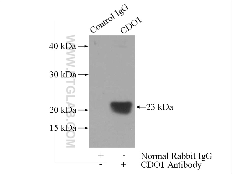 IP experiment of mouse liver using 12589-1-AP