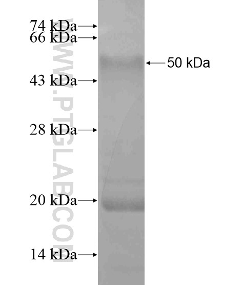 CDR1 fusion protein Ag19688 SDS-PAGE CDR1 fusion protein Ag19688 SDS-PAGE