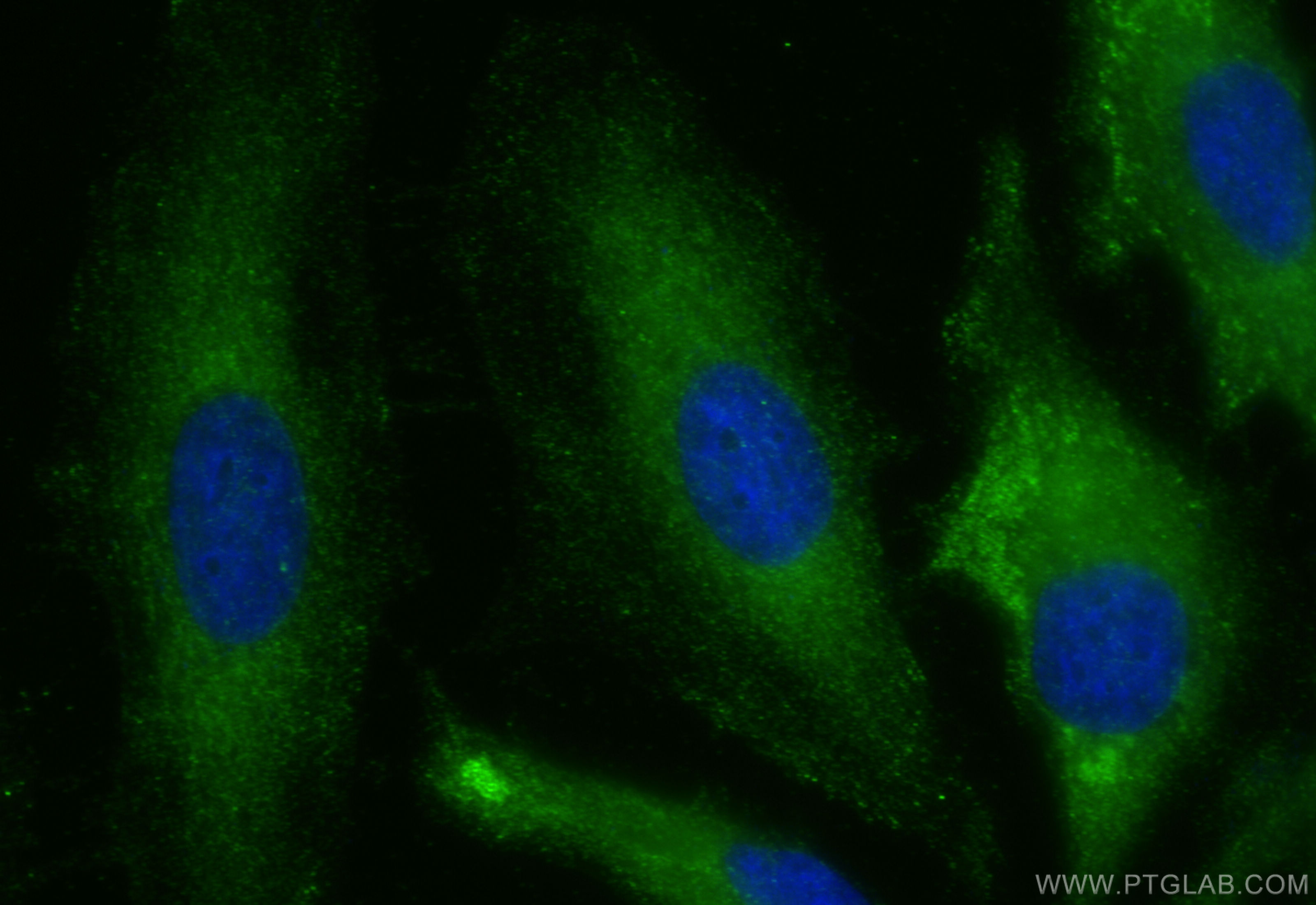 IF Staining of HeLa using 14563-1-AP