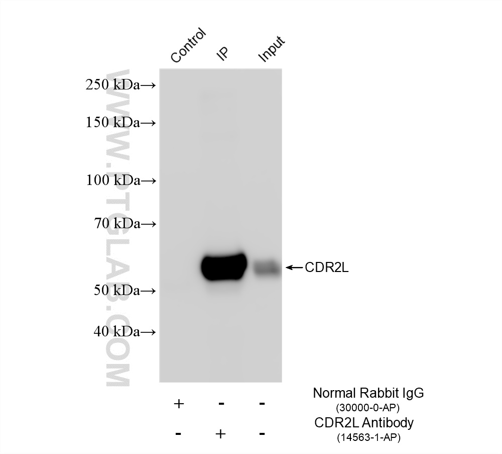 IP experiment of SH-SY5Y using 14563-1-AP IP experiment of SH-SY5Y using 14563-1-AP