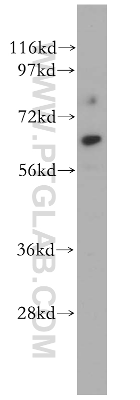 CDR2L