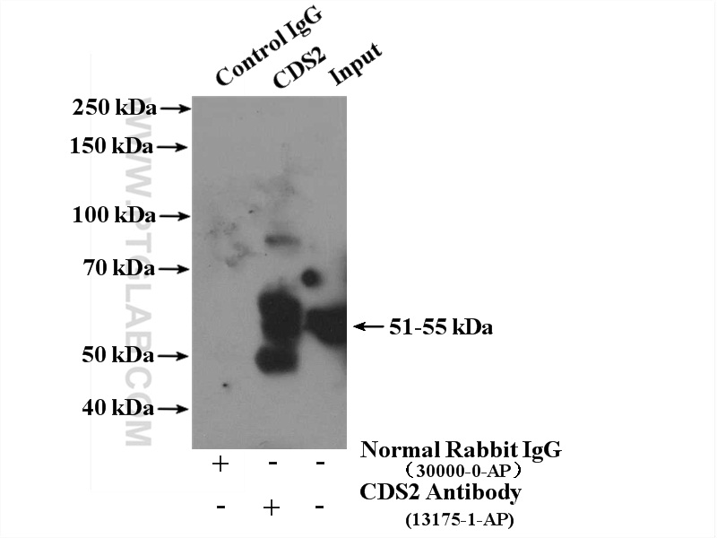 IP experiment of HepG2 using 13175-1-AP