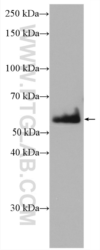 WB analysis of mouse skin using 27953-1-AP