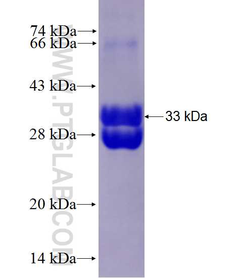 CDSN fusion protein Ag27688 SDS-PAGE