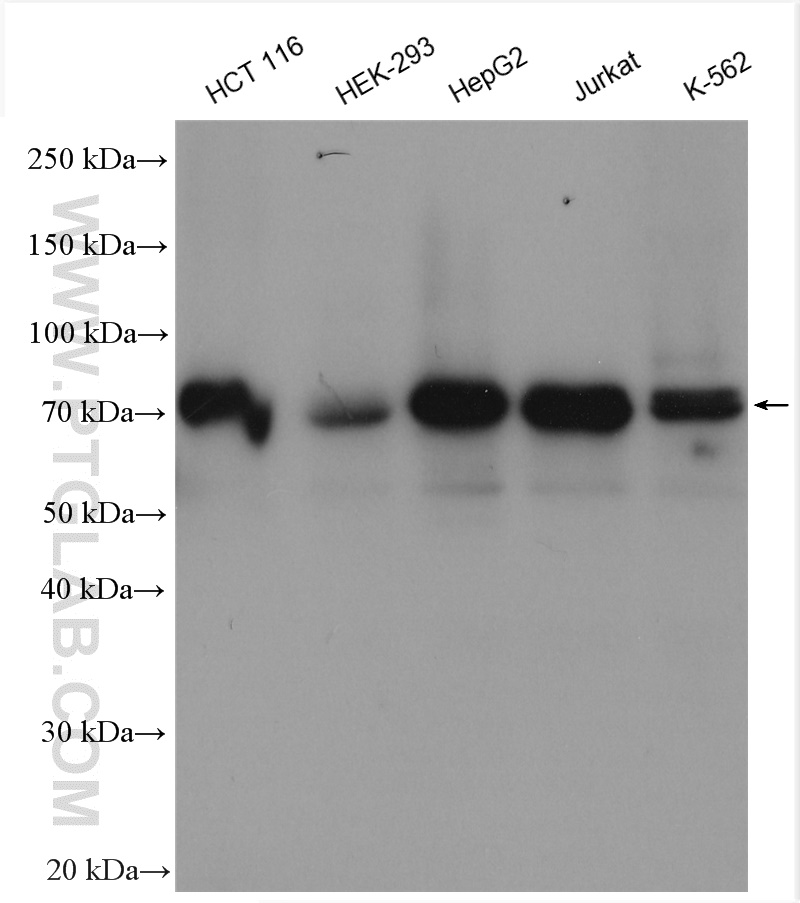 WB analysis using 14382-1-AP