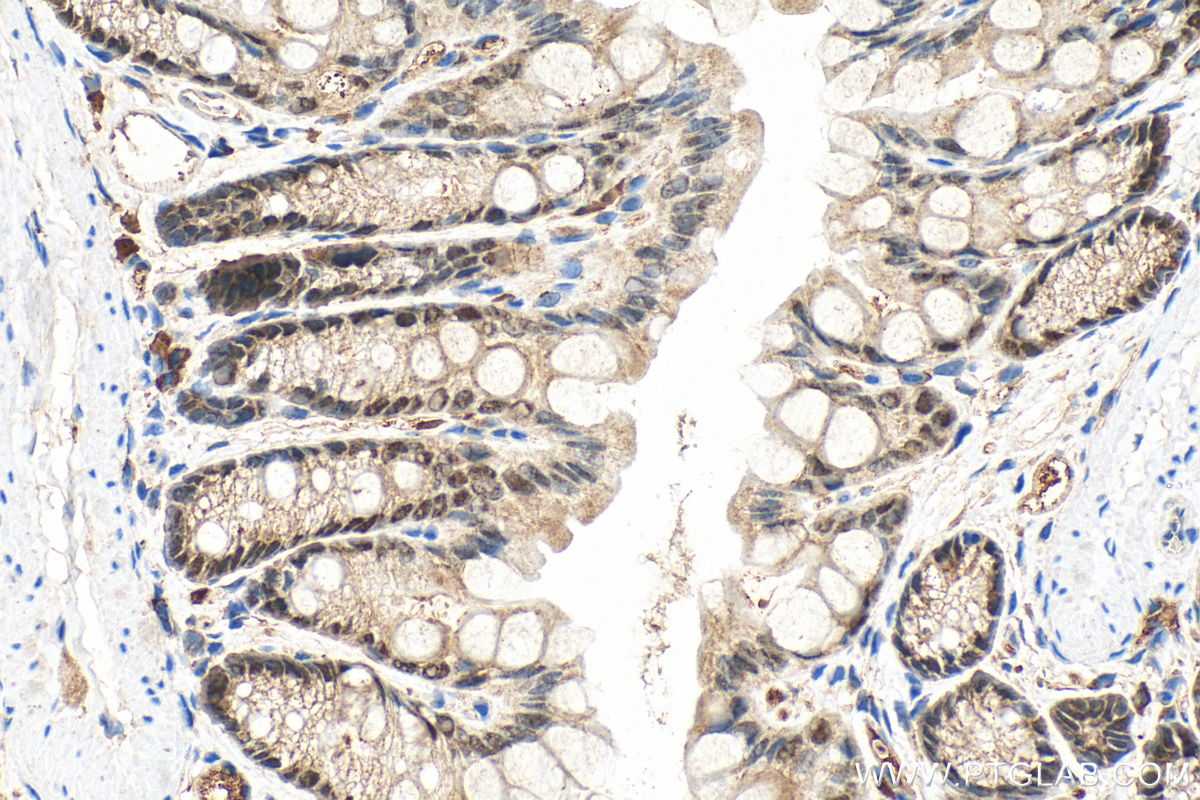 Immunohistochemical analysis of paraffin-embedded mouse colon tissue slide using 21655-1-AP (CDX1 antibody) at dilution of 1:200 (under 40x lens). Heat mediated antigen retrieval with Tris-EDTA buffer (pH 9.0). IHC staining of mouse colon using 21655-1-AP