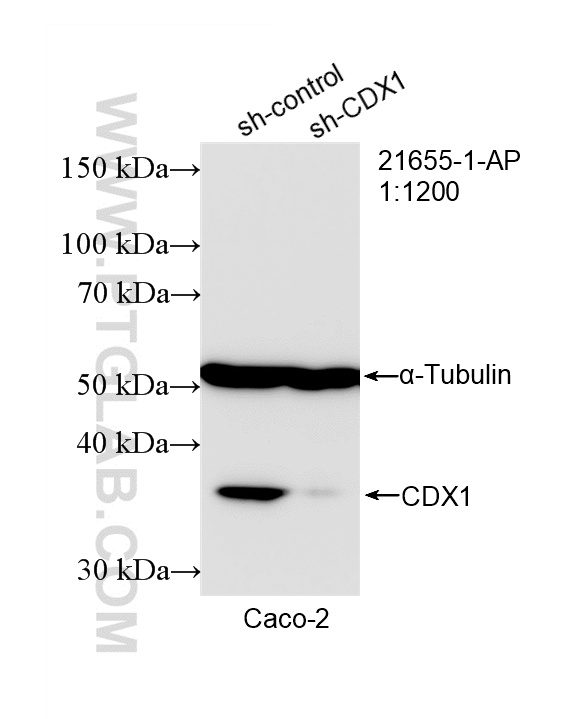 WB analysis of Caco-2 using 21655-1-AP WB analysis of Caco-2 using 21655-1-AP