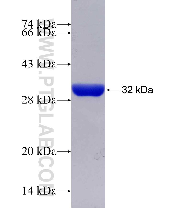 CDX1 fusion protein Ag16376 SDS-PAGE