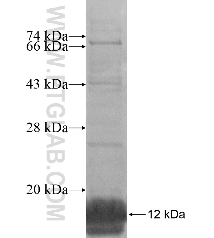CDX1 fusion protein Ag16754 SDS-PAGE CDX1 fusion protein Ag16754 SDS-PAGE