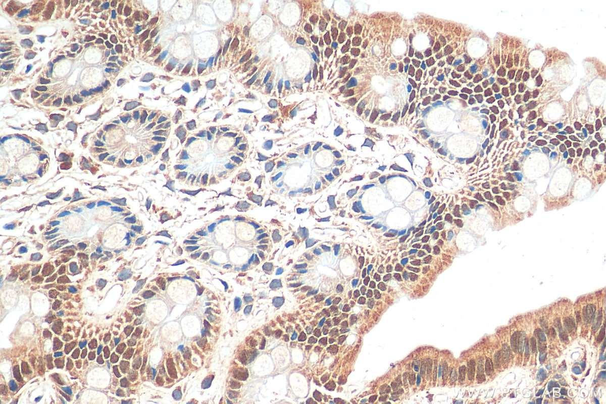 IHC staining of rat colon using 30380-1-AP