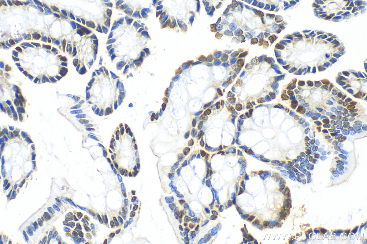 IHC staining of rat colon using 82659-1-RR