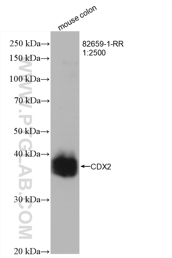 CDX2