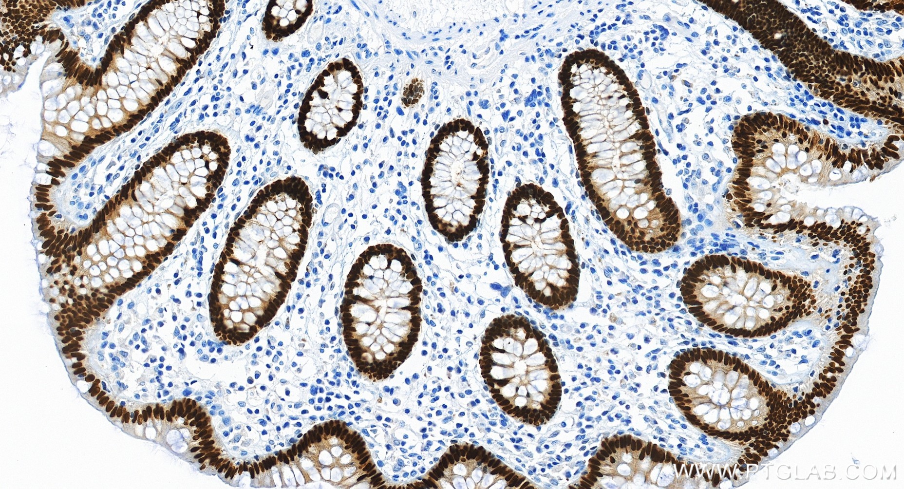 IHC staining of human colon using 82663-1-RR IHC staining of human colon using 82663-1-RR