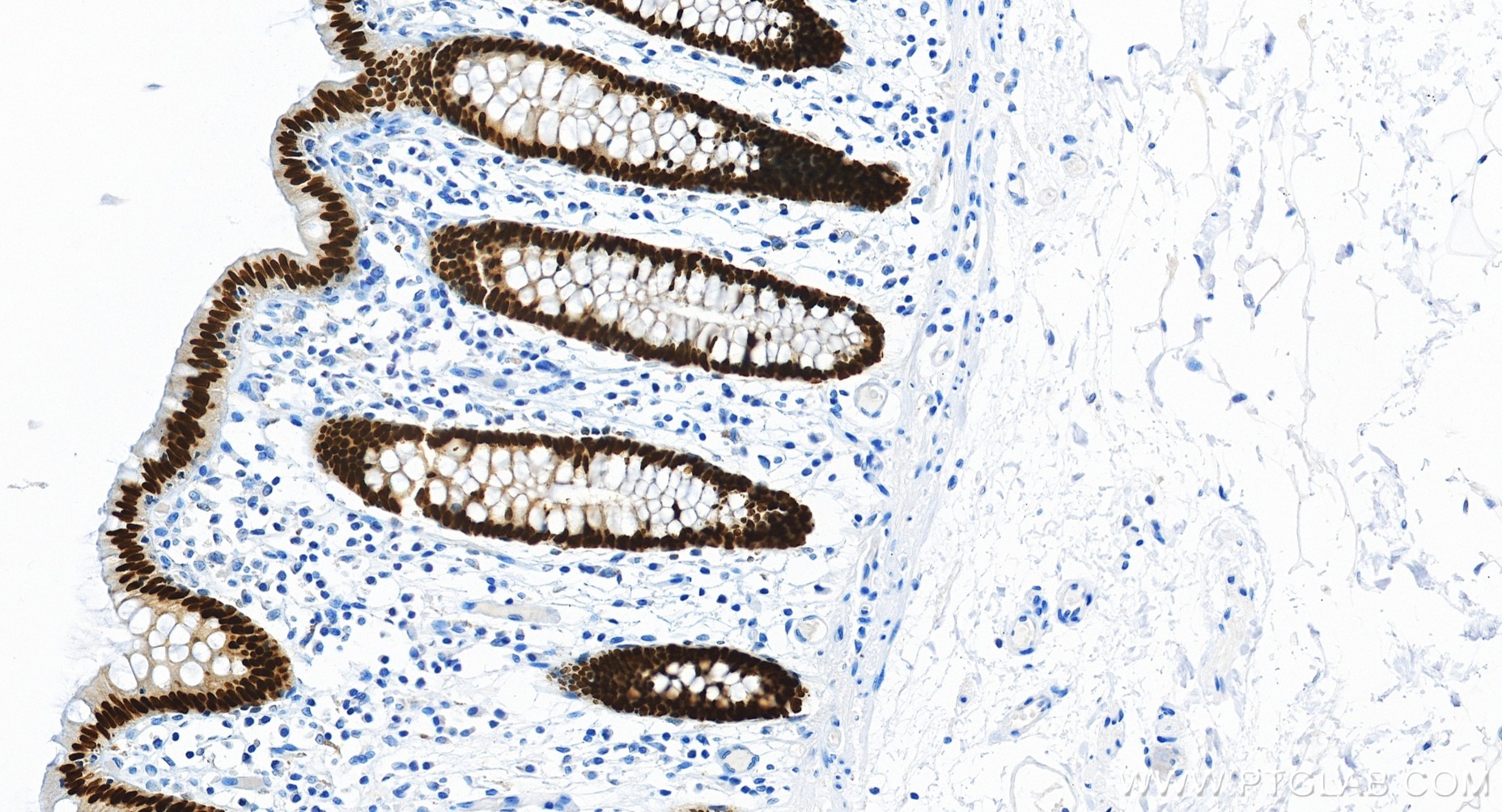 IHC staining of human colon using 82663-1-RR IHC staining of human colon using 82663-1-RR