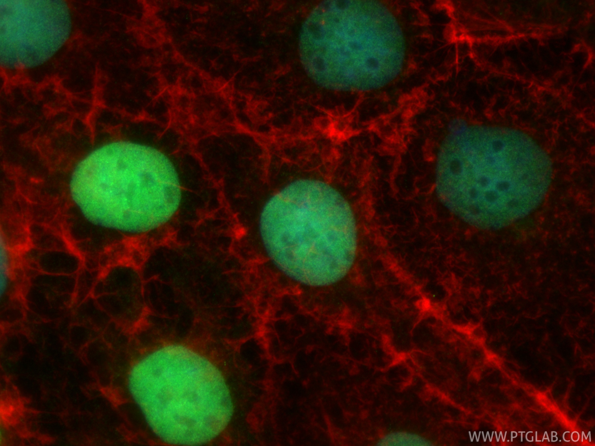 IF Staining of Caco-2 using 82663-1-RR (same clone as 82663-1-PBS) IF Staining of Caco-2 using 82663-1-RR (same clone as 82663-1-PBS)