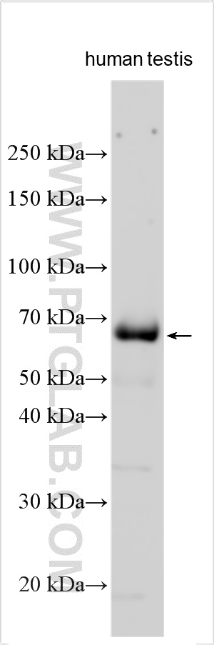 WB analysis using 33231-1-AP