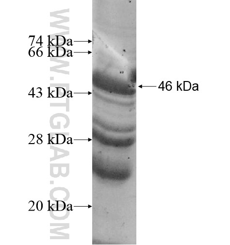 CDYL fusion protein Ag12387 SDS-PAGE CDYL fusion protein Ag12387 SDS-PAGE