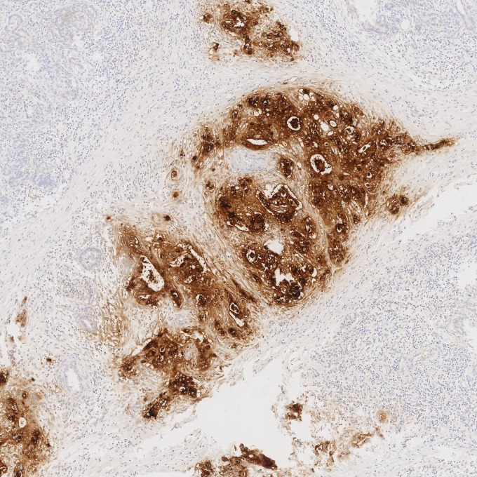 IHC staining of human pancreas using 68377-1-Ig