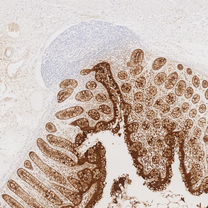IHC staining of human large intestine using 68377-1-Ig