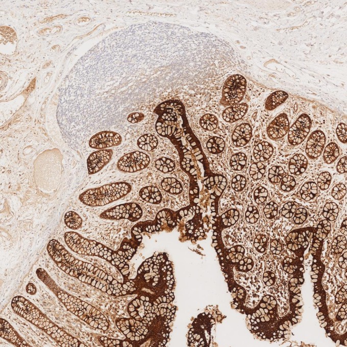 IHC staining of human large intestine using 68377-1-Ig