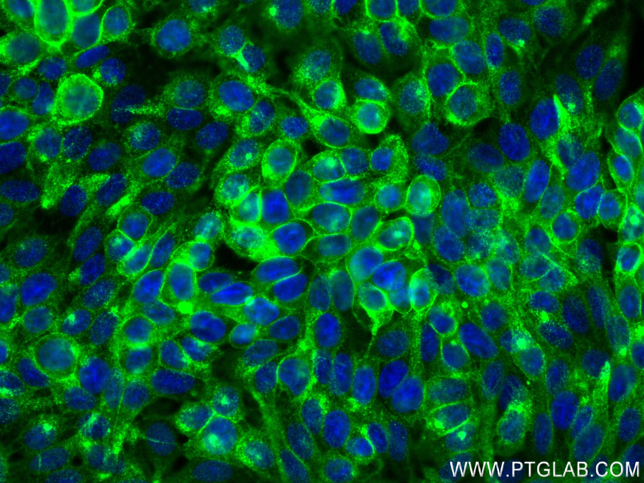 IF Staining of HT-29 using 83653-5-RR (same clone as 83653-5-PBS)