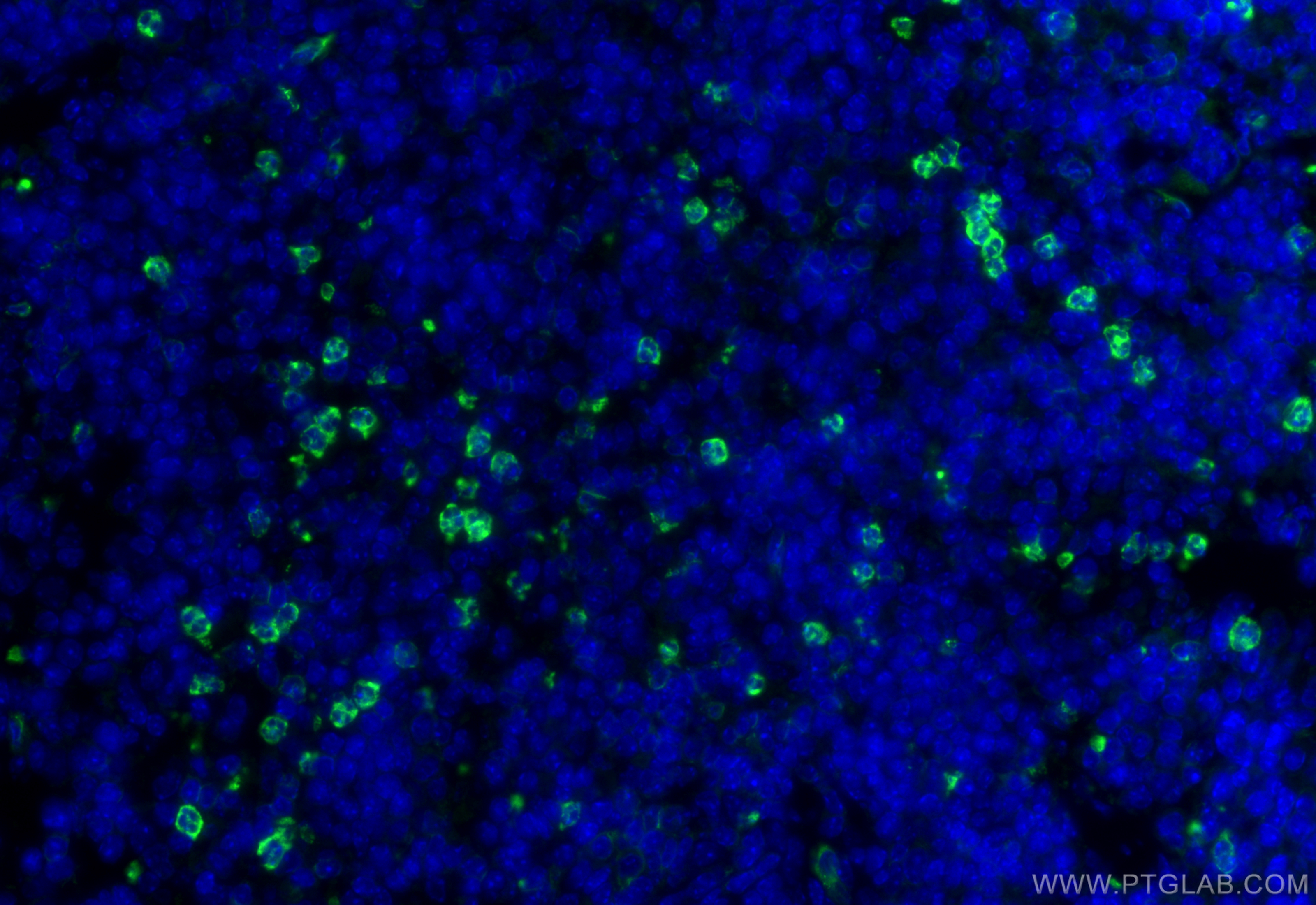 IF Staining of mouse spleen using 32395-1-AP
